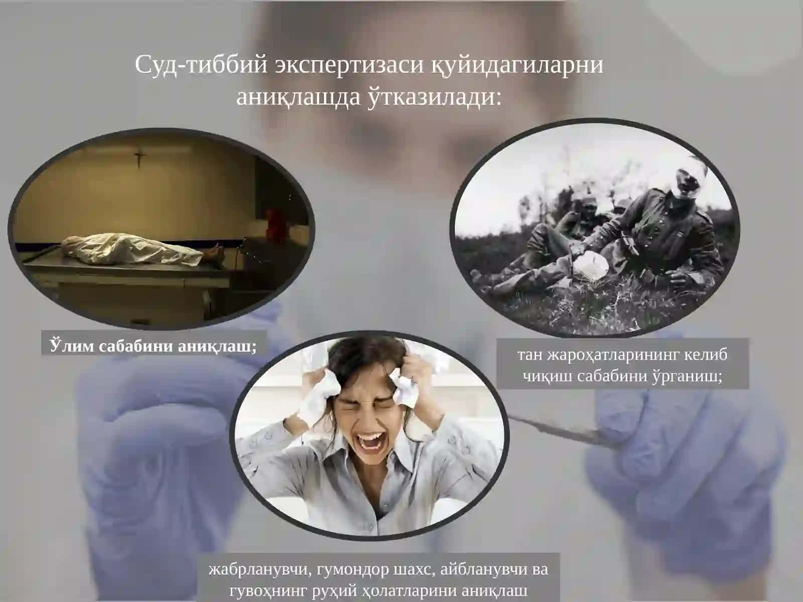 Суд-тиббий експертизаси 4