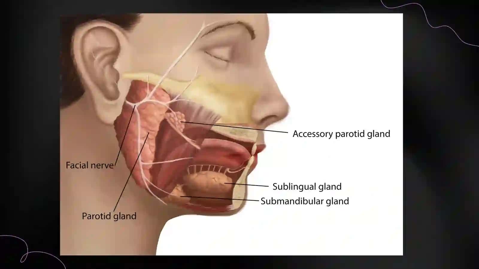 Mumps and Orchitis 4