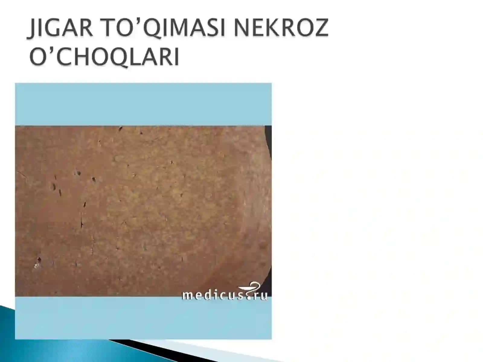 JIGARSIRROZI 4