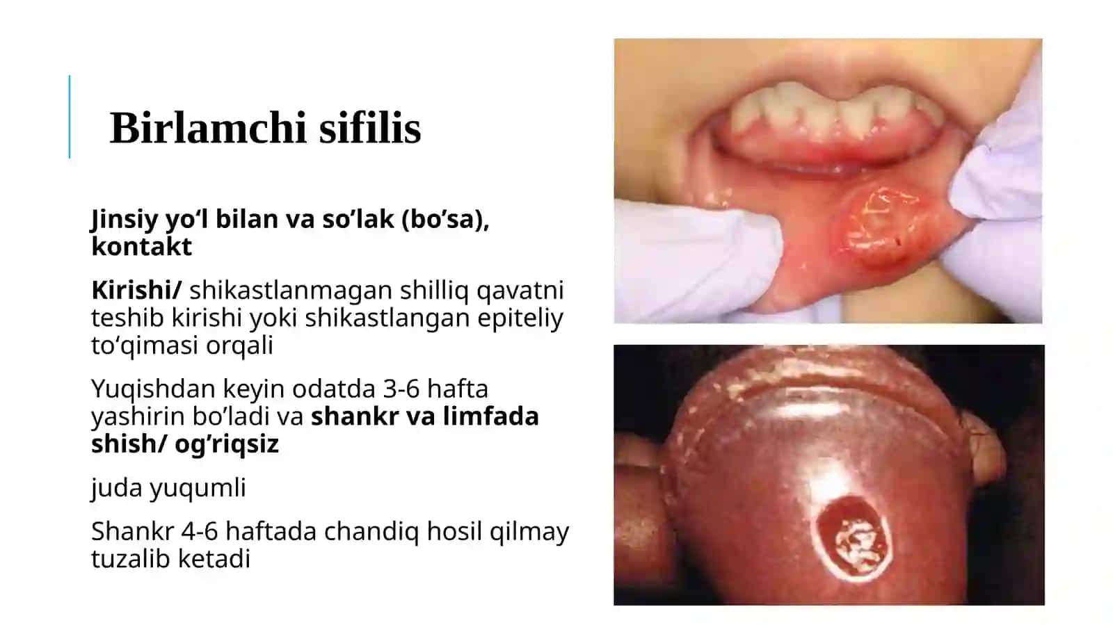 Spiroxetalar 4