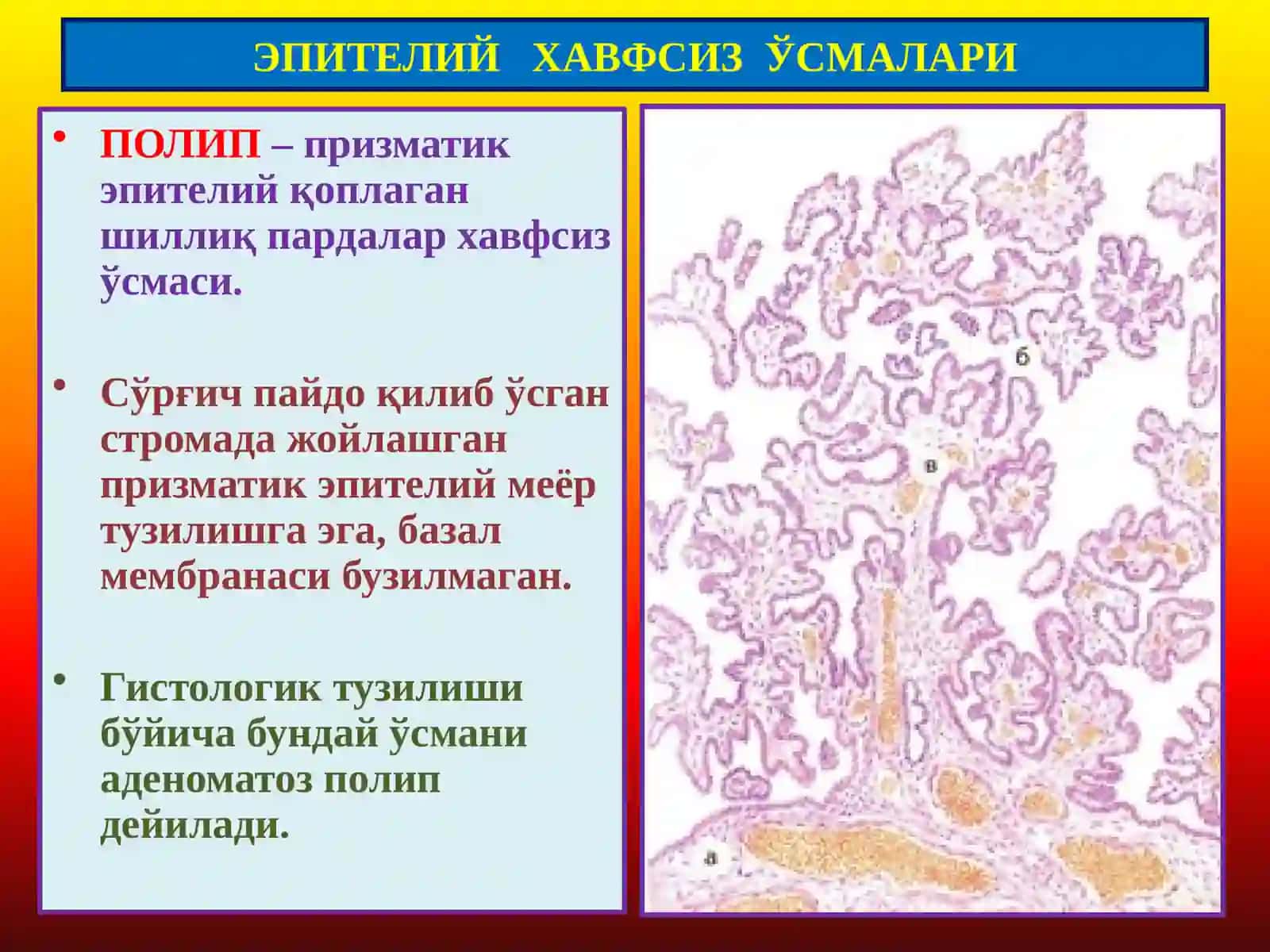 Ўсмалар. Мезенхимал ўсмалар 4