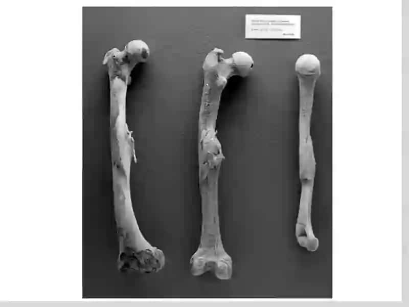 The skeletal system of a human being 4