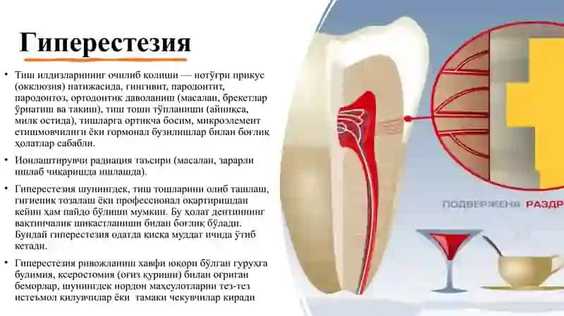 Giperesteziya 4