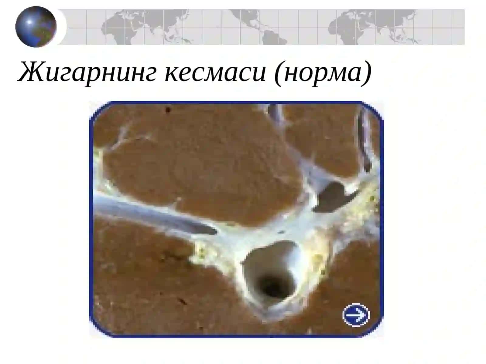СУРУНКАЛИ ГЕПАТИТ 4