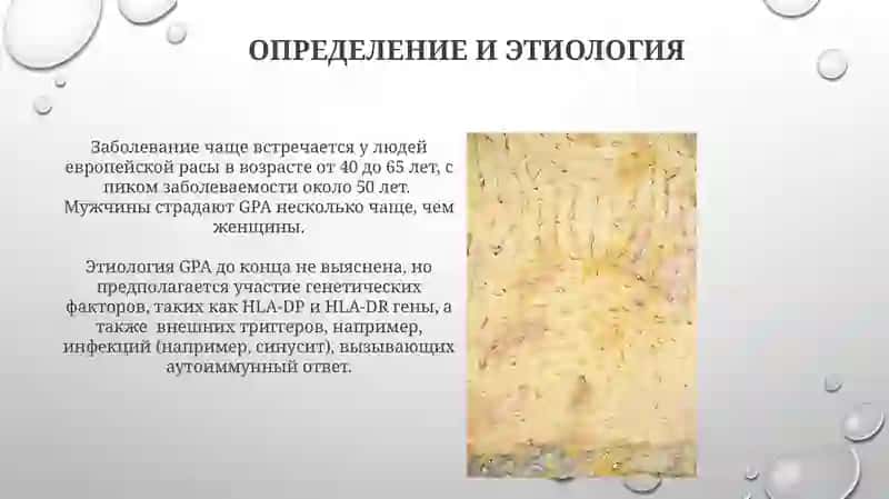 Гранулематоз вегенера 4