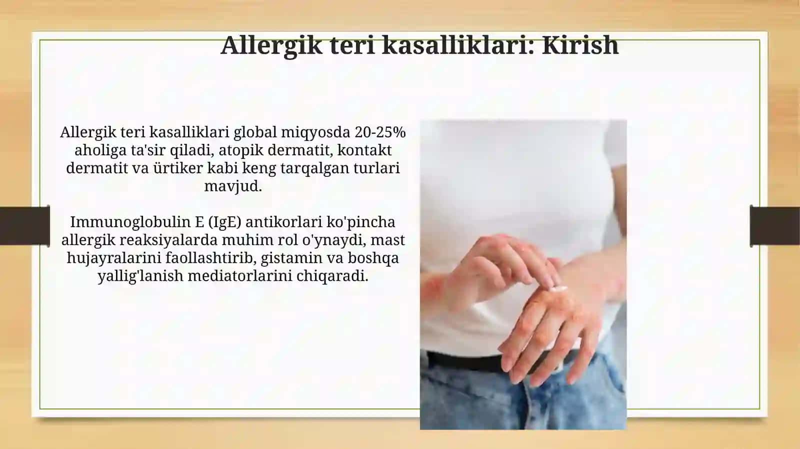 Terining allergik kasalliklari 4