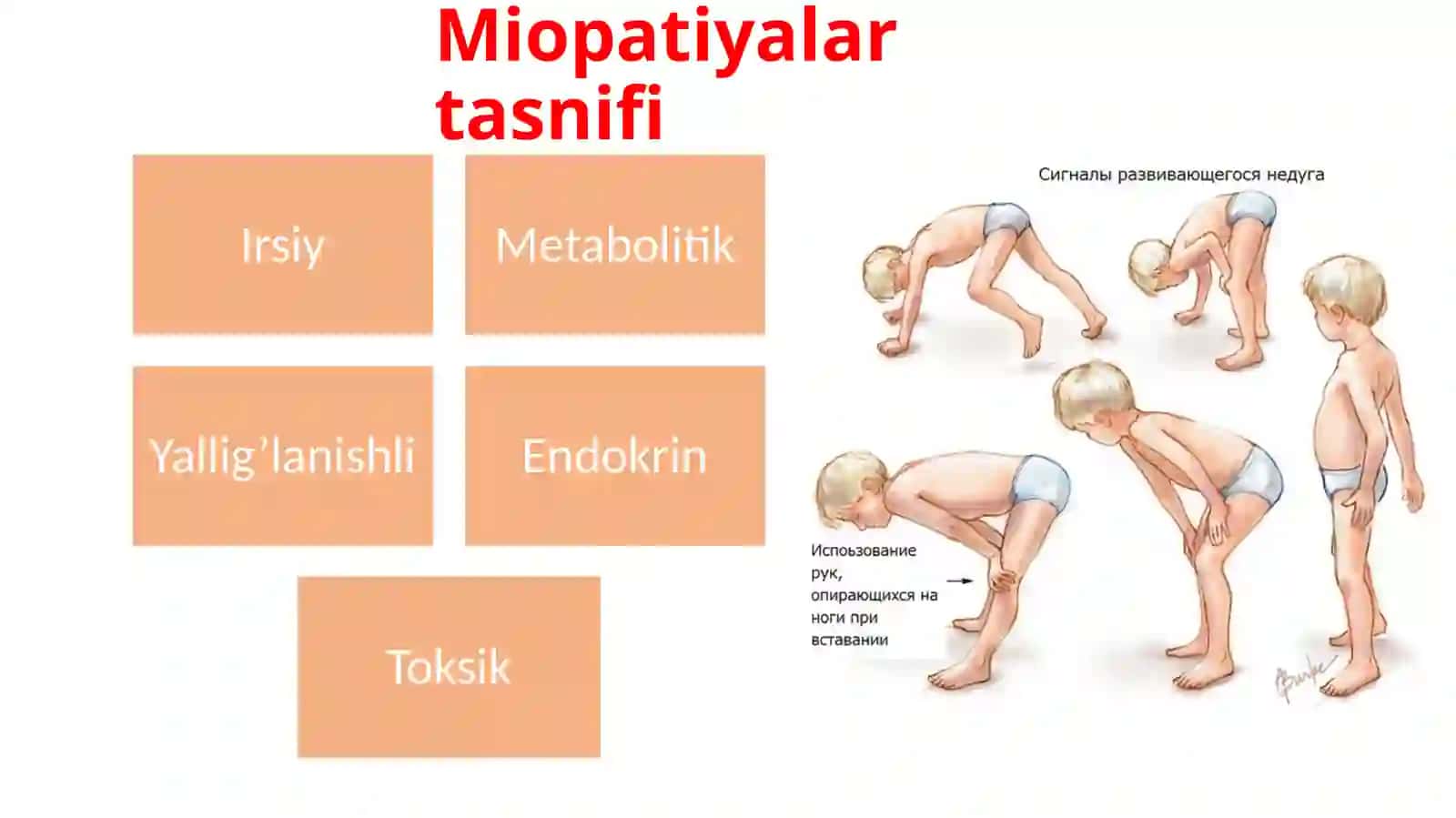Miopatiyalar. Mushak denervatsiyasi 4