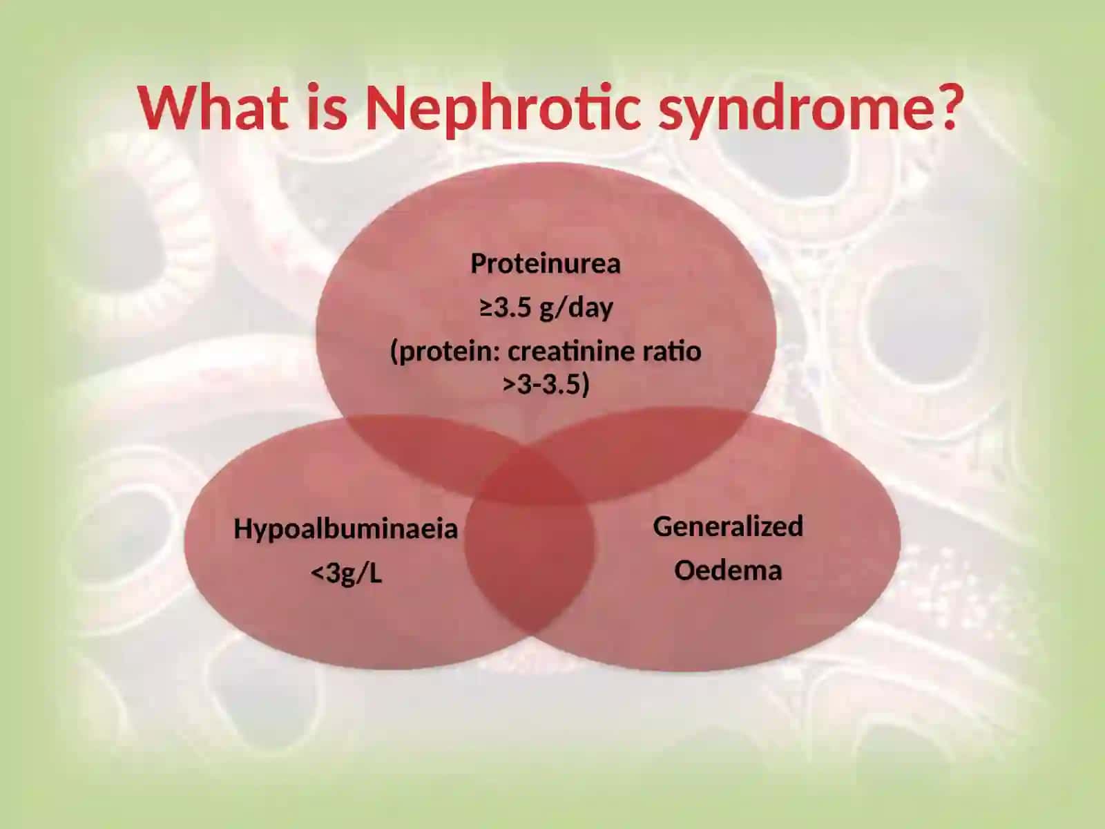 NephroticSyndrome 4