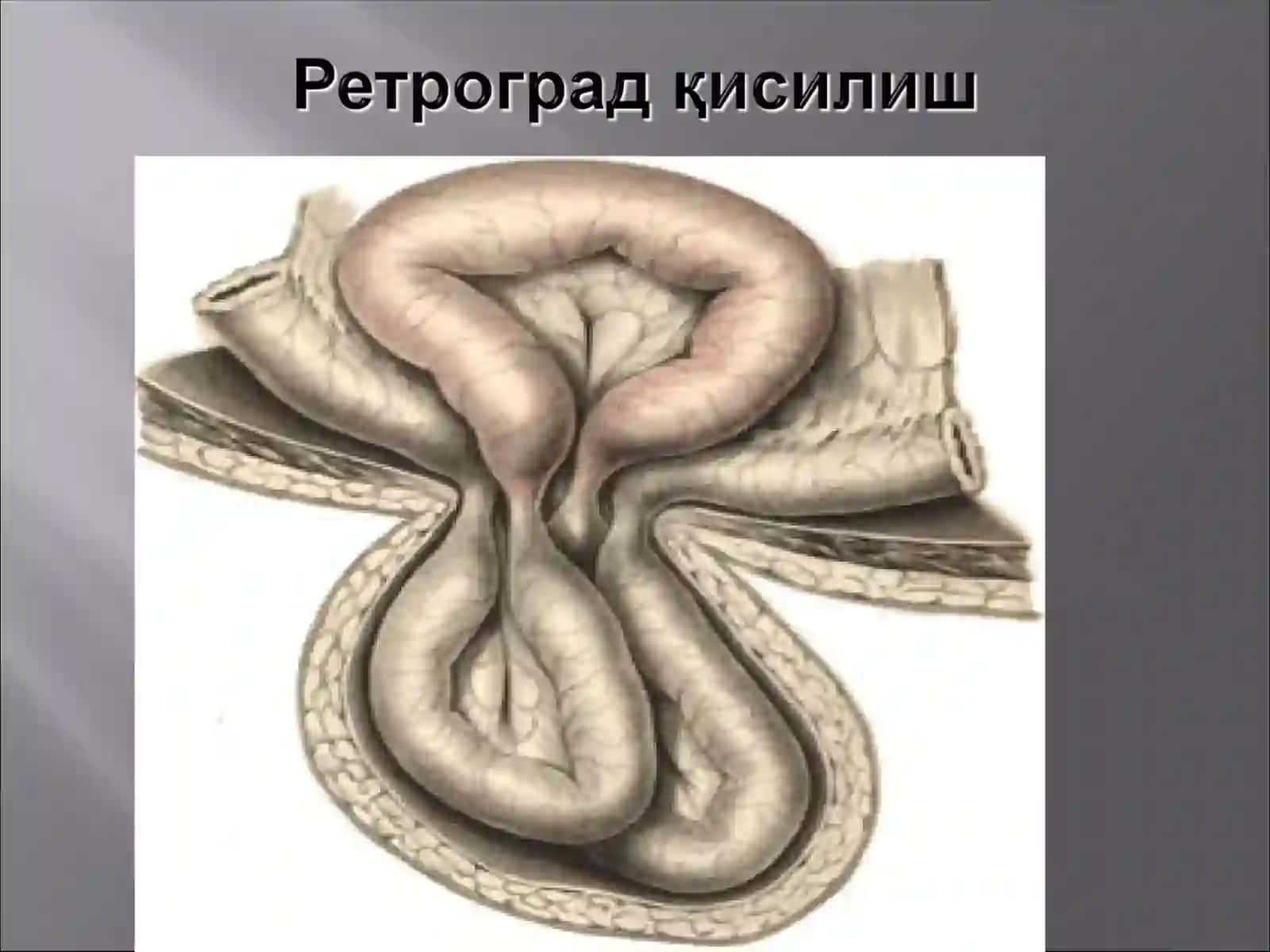 Қисилиш 4