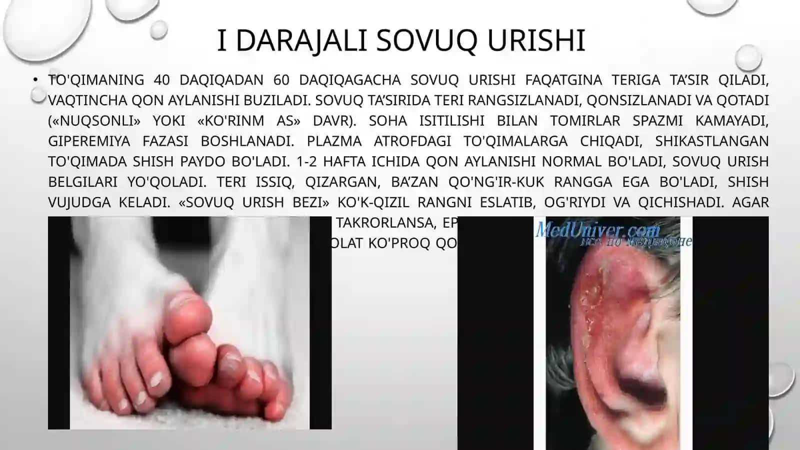 Sovuq urishi 4