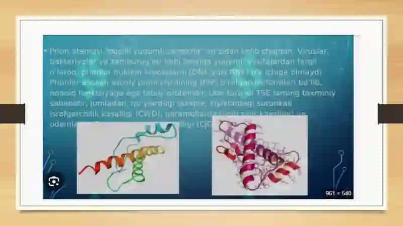 Prion kasalliklari 4