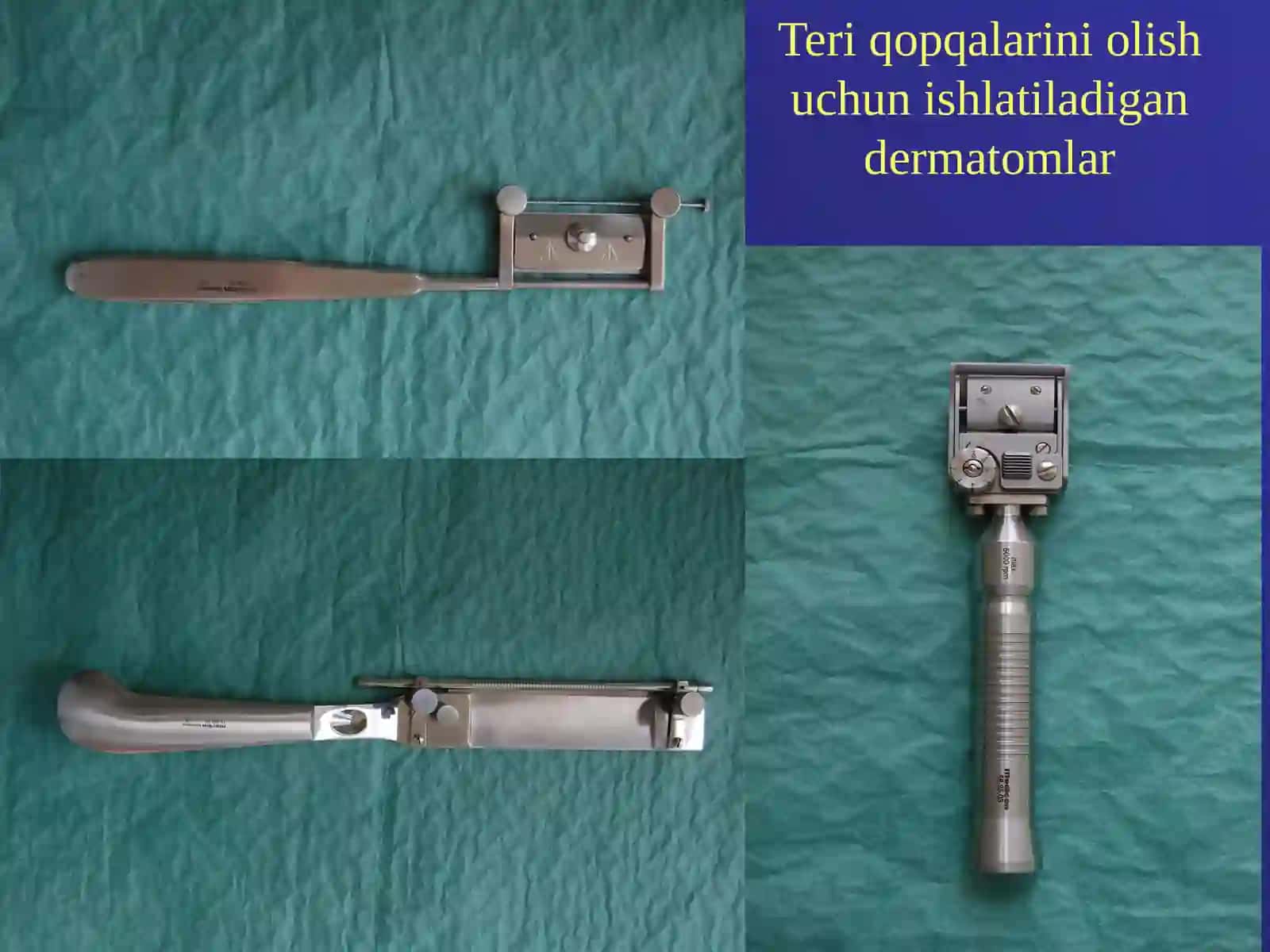 TO'QIMATRANSPLANTASIYASI 4