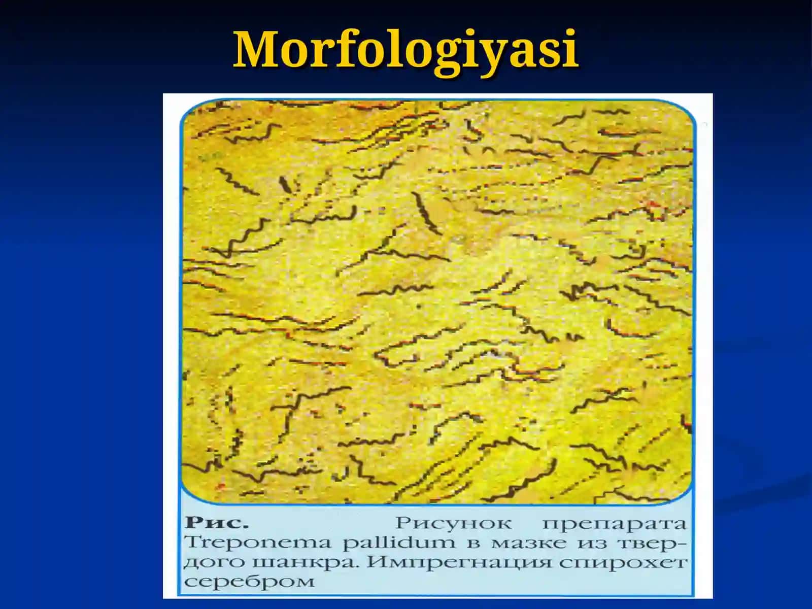 Treponema pallidum 4