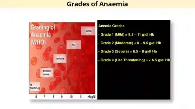 Anemia 4