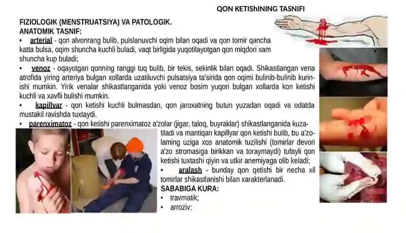 Qon Ketusish 4