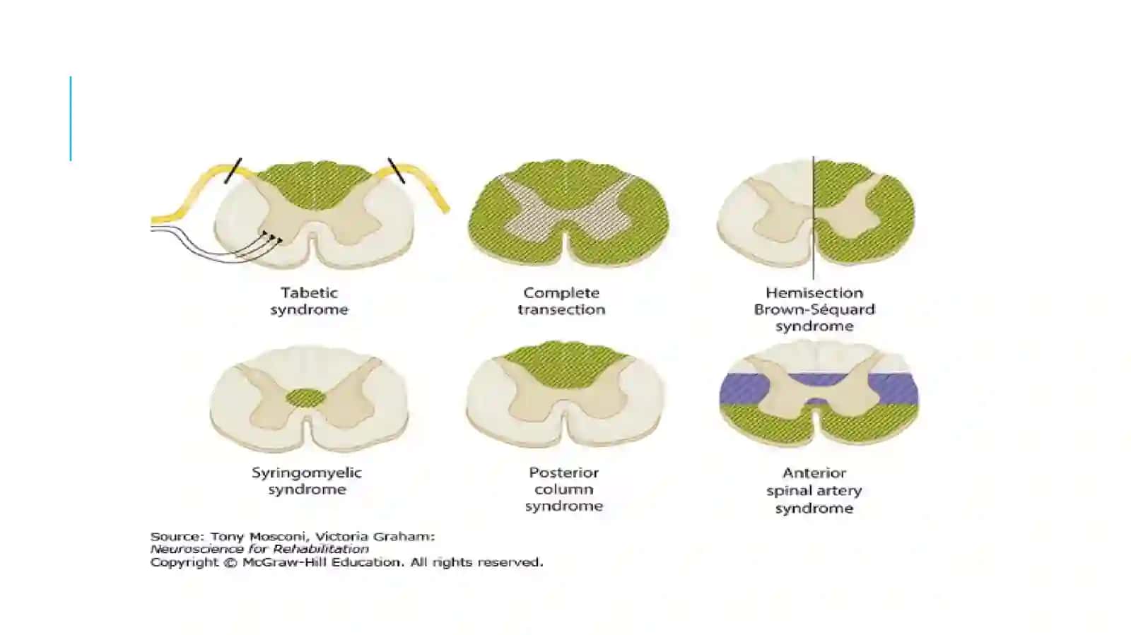 DERMATOMES 4