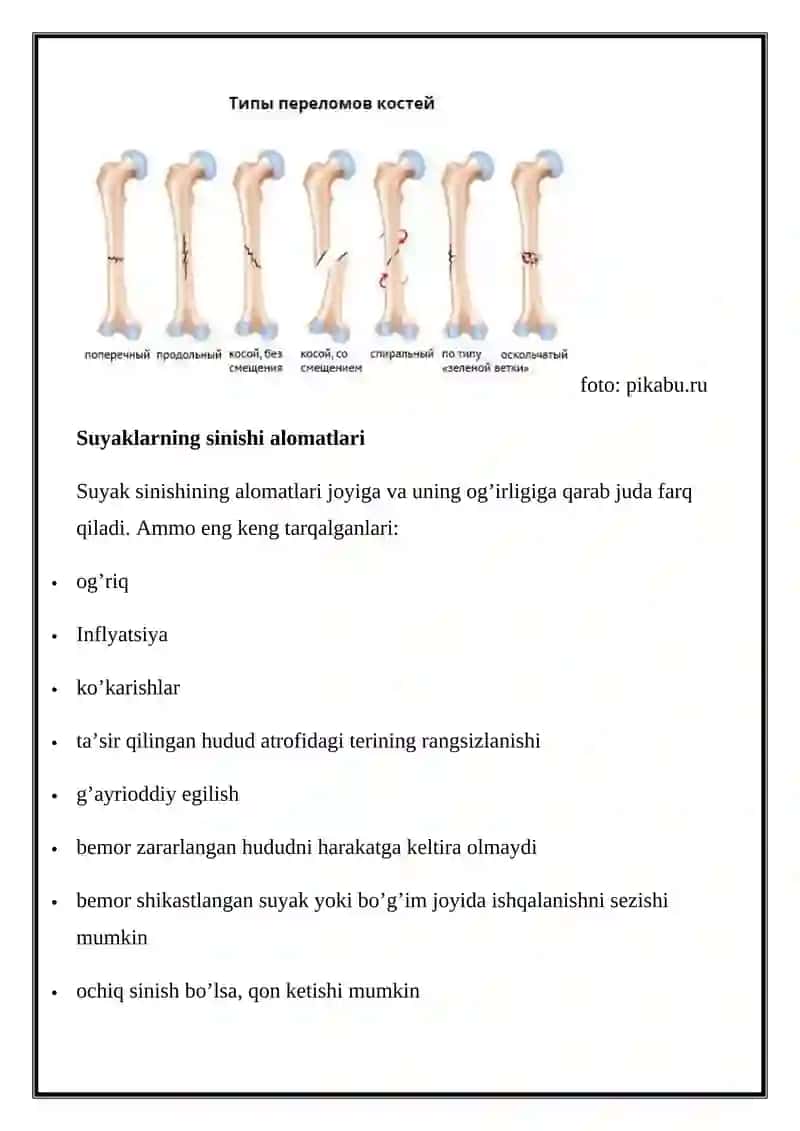 Suyak sinishi 4