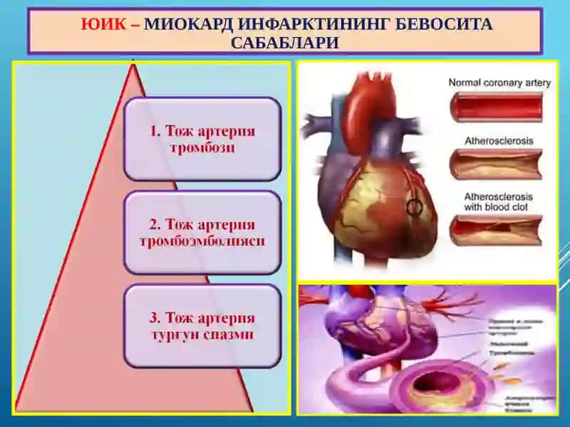 ЮРАК ИШЕМИК КАСАЛЛИГИ - ЮИК 4
