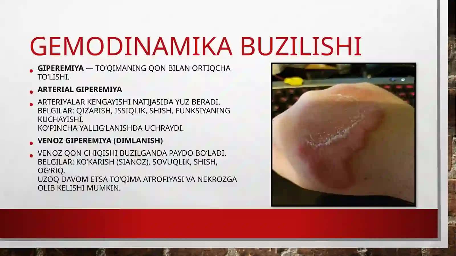 Tema:Gemodinamika buzulishi 4