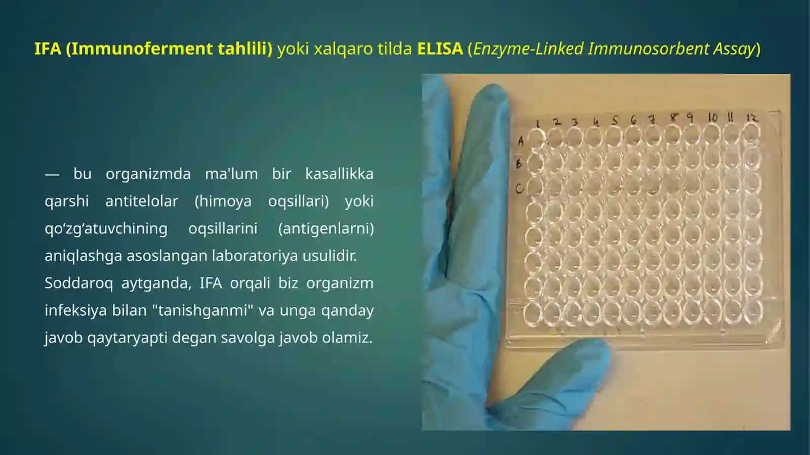 IFA VA PZR DIAGNOSTIK USULLAR 4