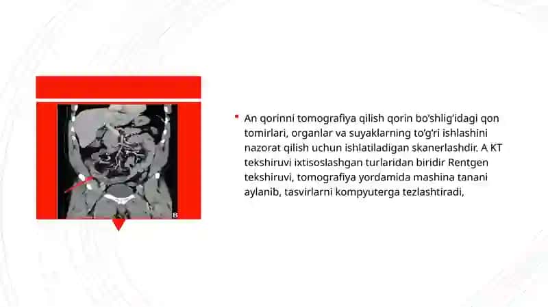 Kompyuter tomografiyasi 4