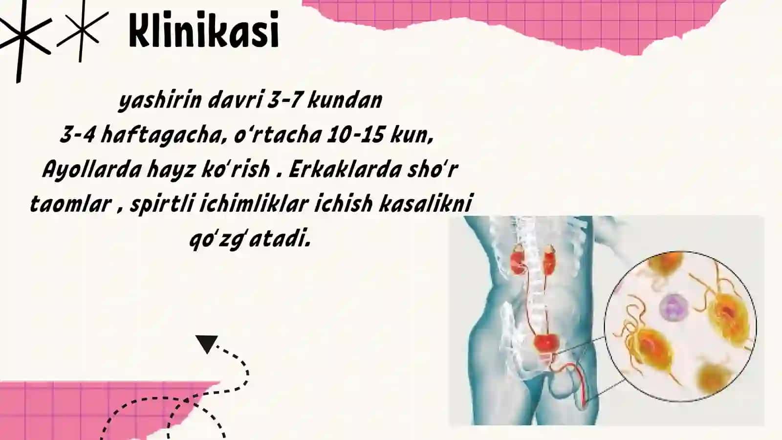 Trixomoniaz 4