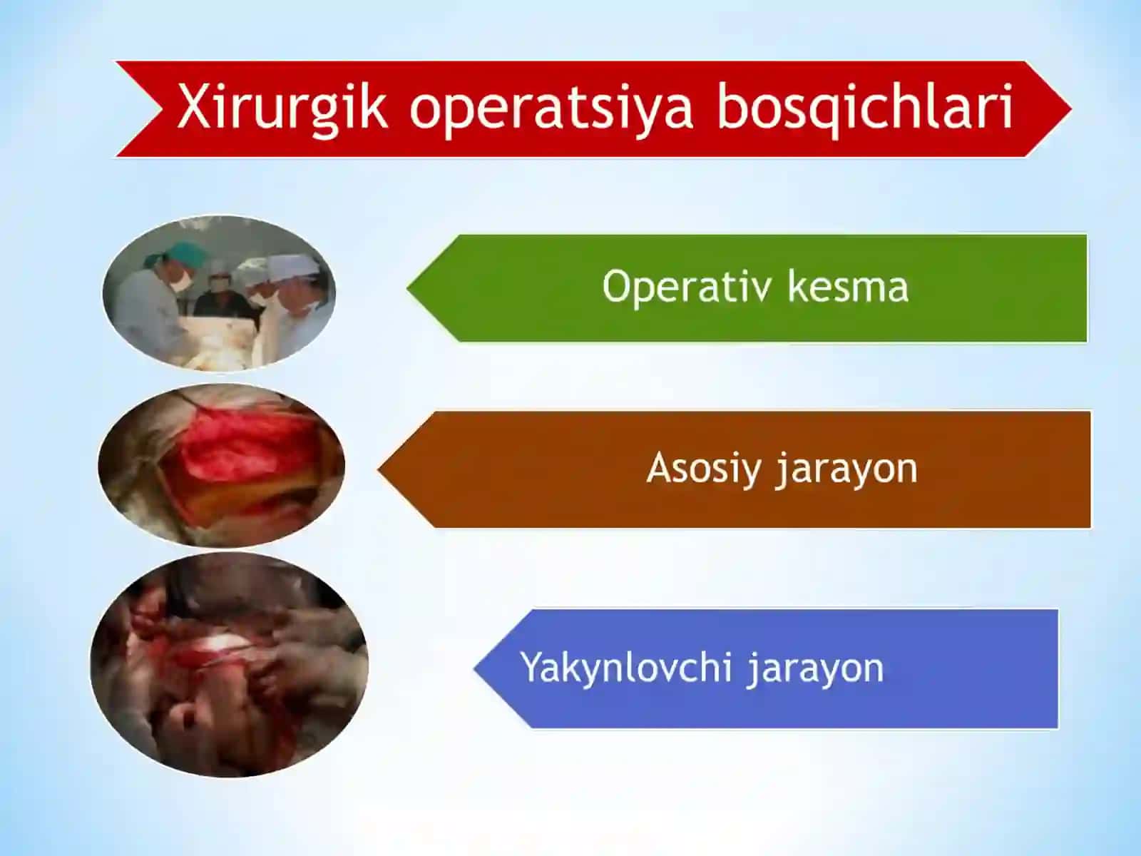 Jarrohlik operatsiyasi 4