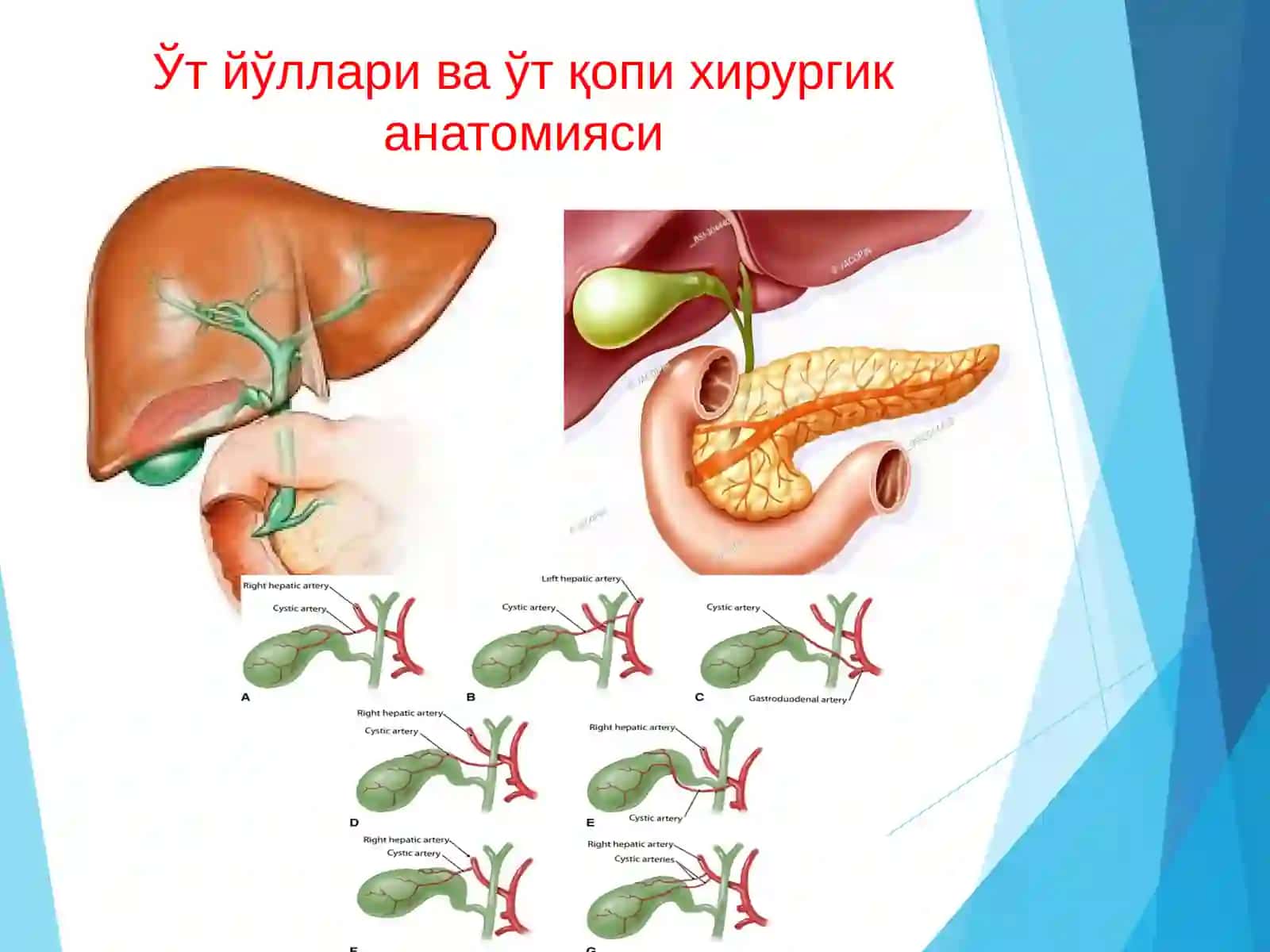 Ўт тош касалликлари 4