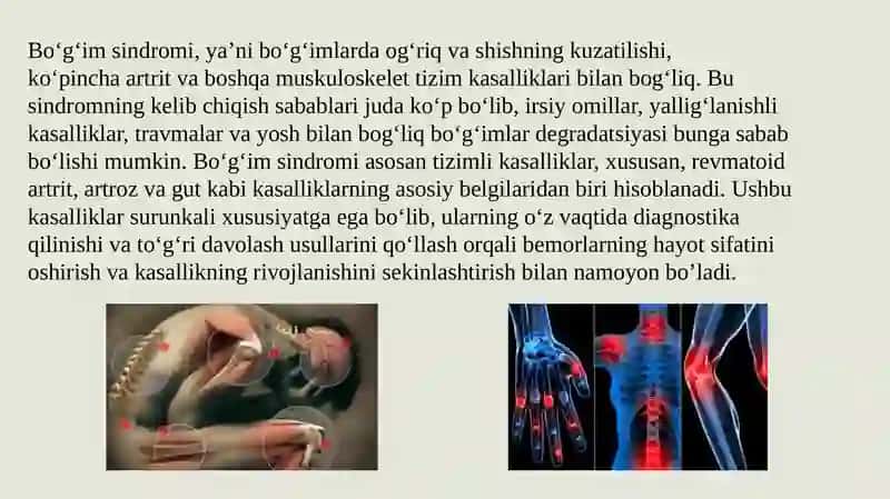 Bo‘g‘im sindromi 4