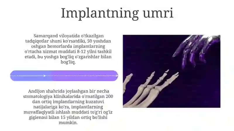 Tish implantlari 4