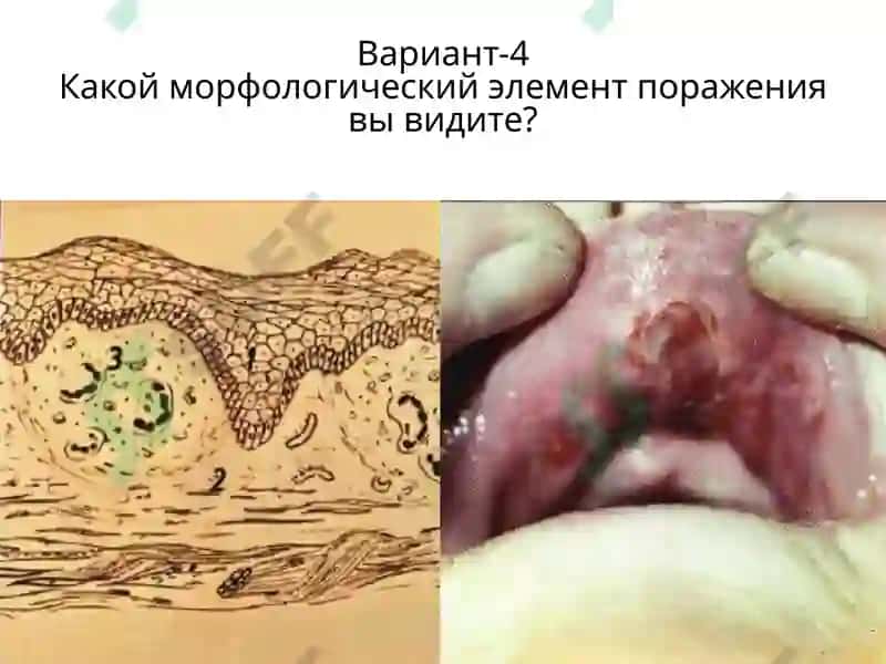 Вариант-1 4