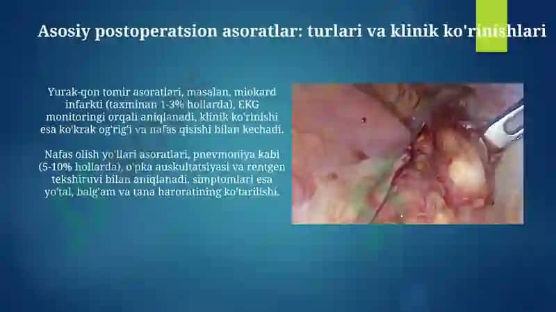 Asoratlar va ularning profilaktikasi 4
