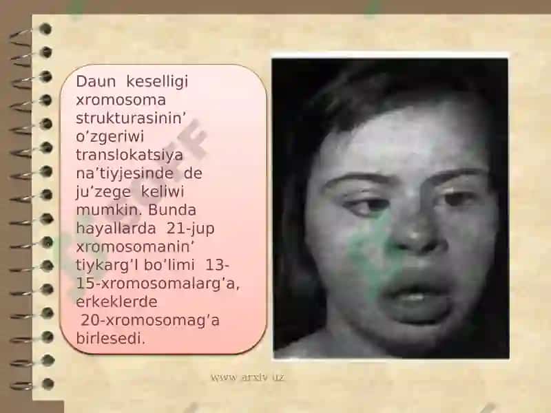 Daun Sindromi 4