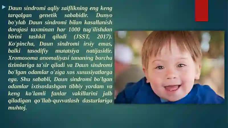 Daunsindromi 4