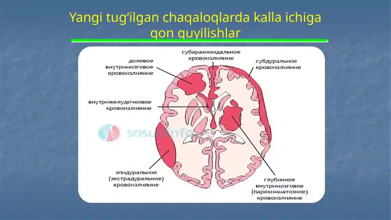 Yuz nervi falaji 4