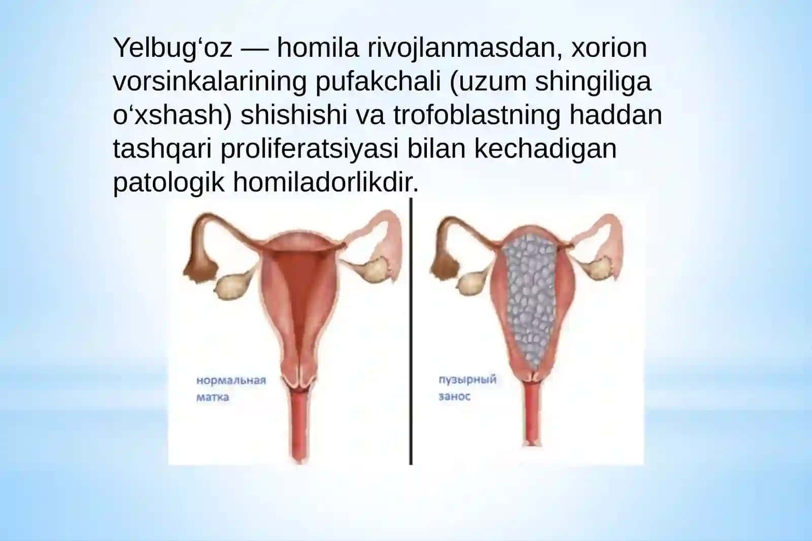 Trofoblastik kasalliklar 4