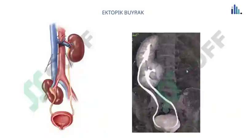 Renal Panalogiya 5