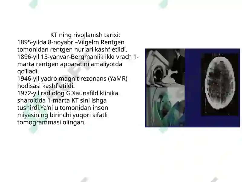 Kompyuter tomografiyasi 5