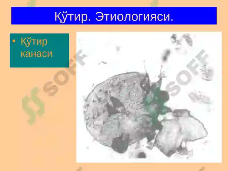 Терининг паразитар касалликлари 5
