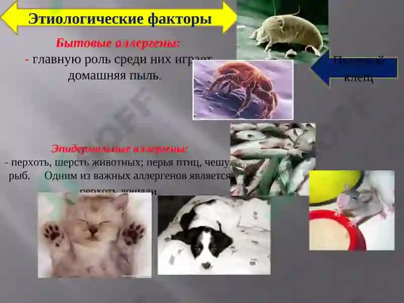 Allergologiyada tekshirish usullari 6