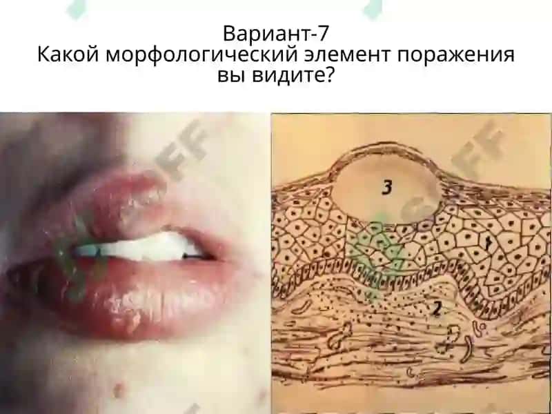 Вариант-1 7