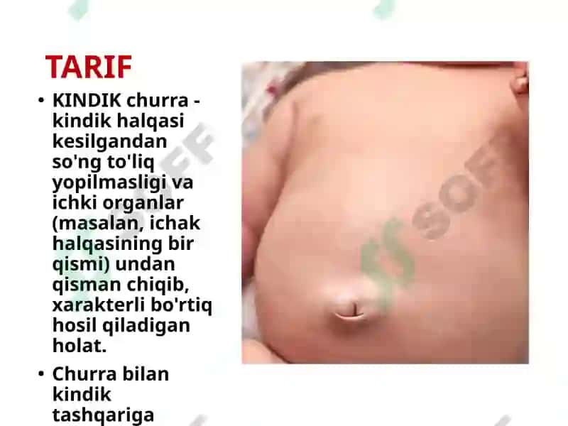 Kindik churrasi 8