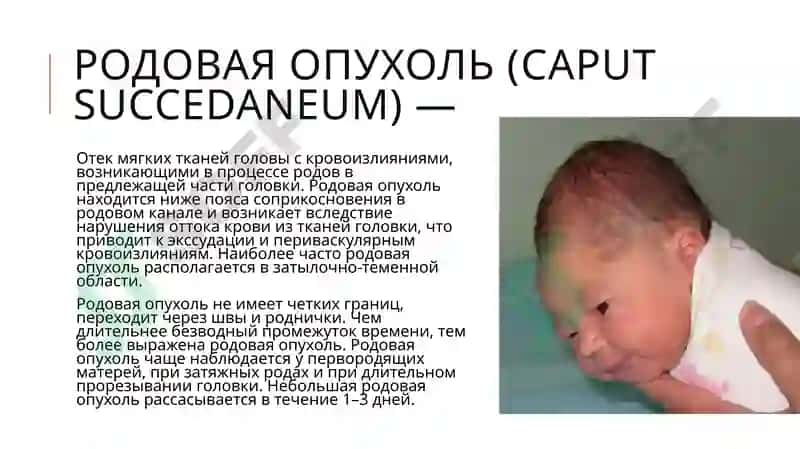 Родовые травмы 8