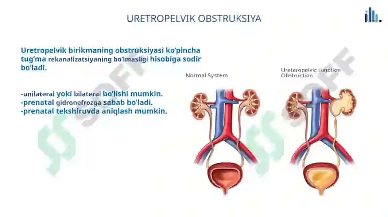 Renal Panalogiya 8