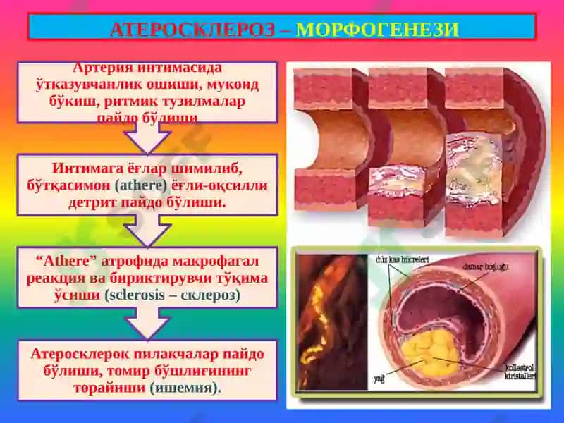 Қон томирлар патологияси. Томир аномалиялари. Гипертензия. Атеросклероз. Аневризмалар. Юрак патологияси Туғма юрак пороклари. ЮИК 8