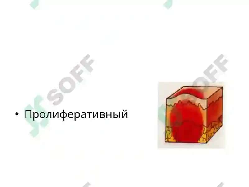 Инфекционные экзантемы 8