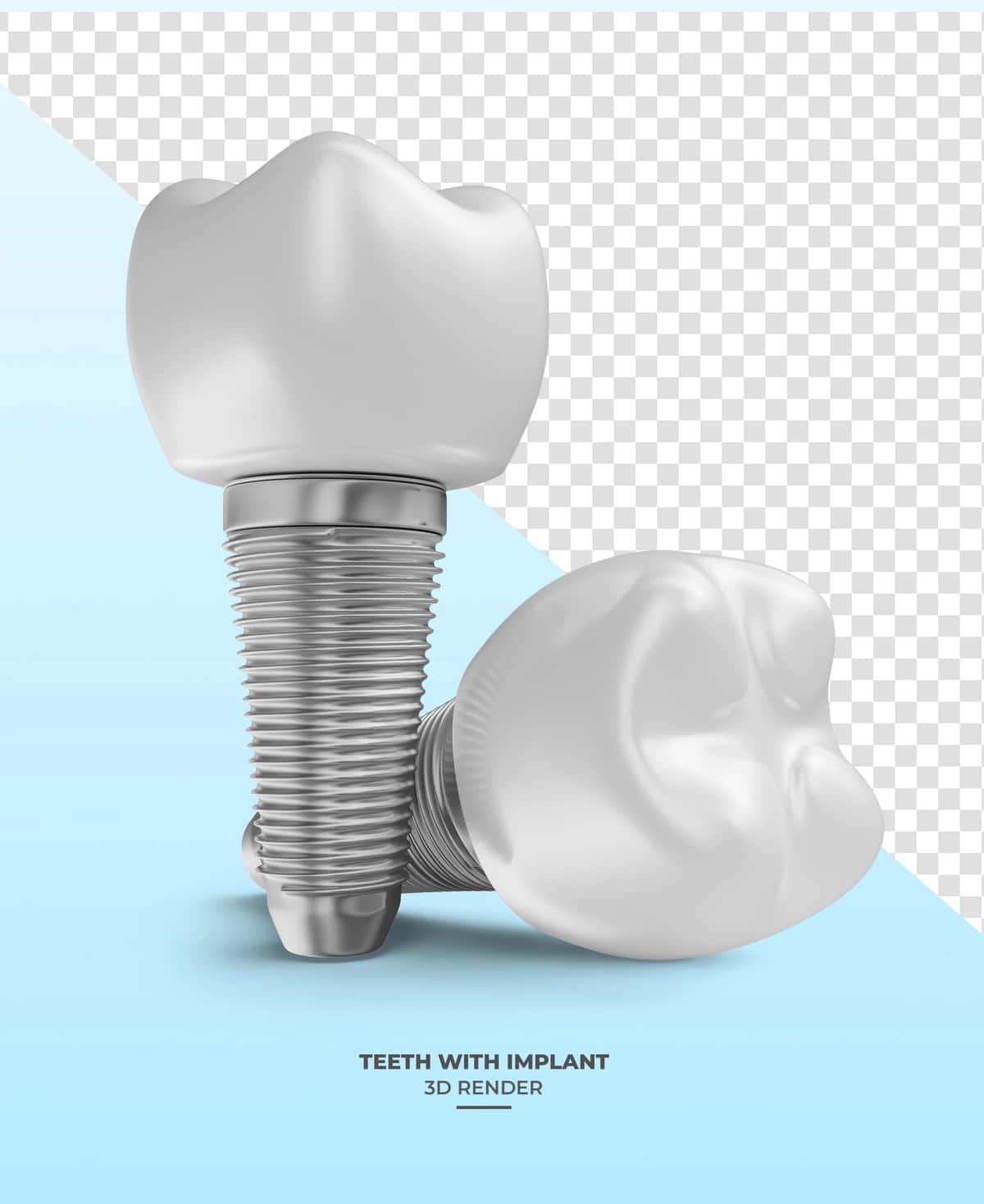 Shaffof fon bilan implantlangan tishning 3D render tasviri | Tooth with implants 3d render with transparent background 1