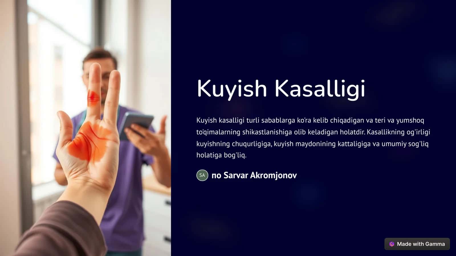 Kuyish Kasalligi
