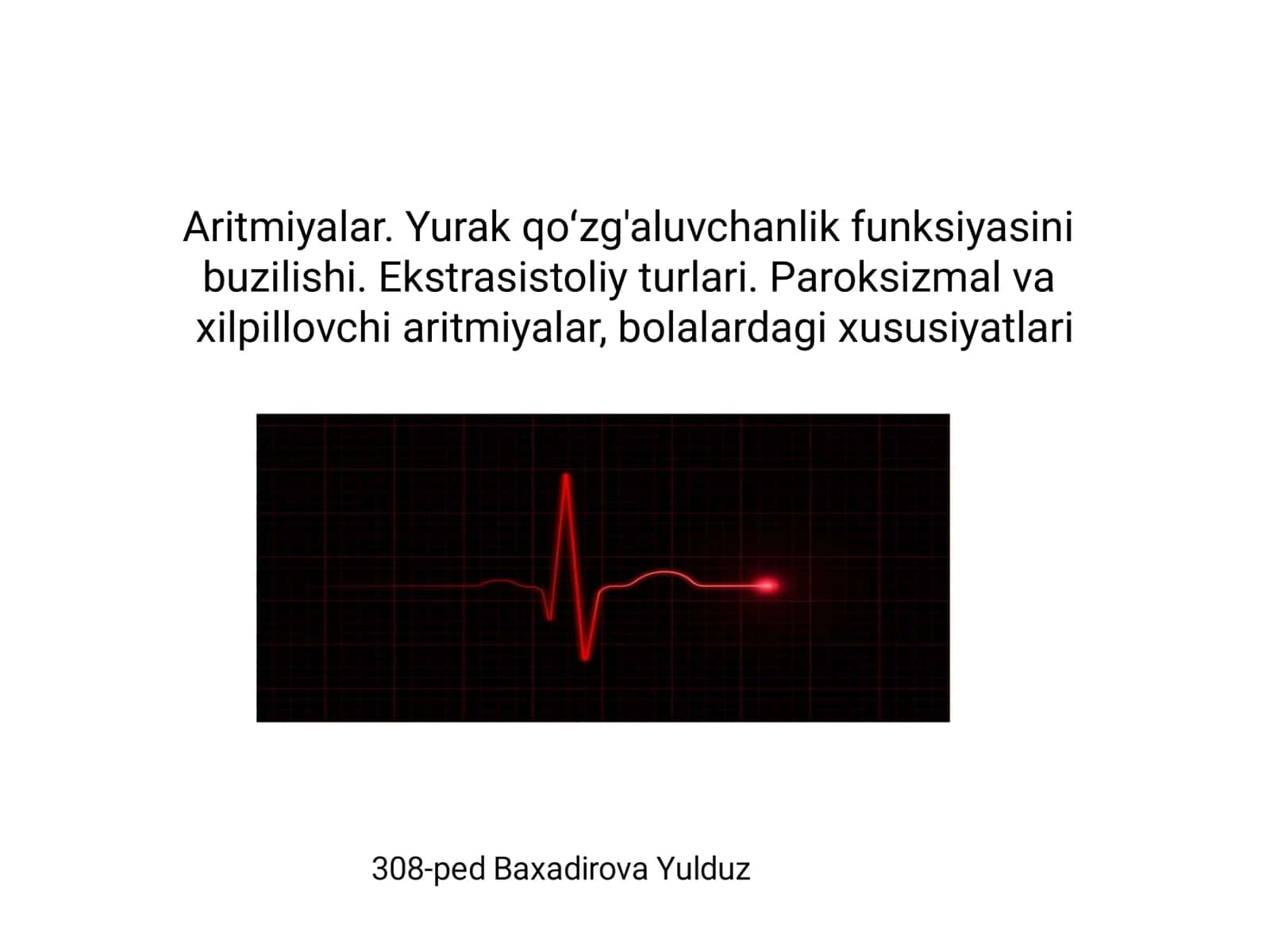 Aritmiyalar. Yurak qoʻzg'aluvchanlik funksiyasini buzilishi. Ekstrasistoliy turlari. Paroksizmal va xilpillovchi aritmiyalar, bolalardagi xususiyatlari