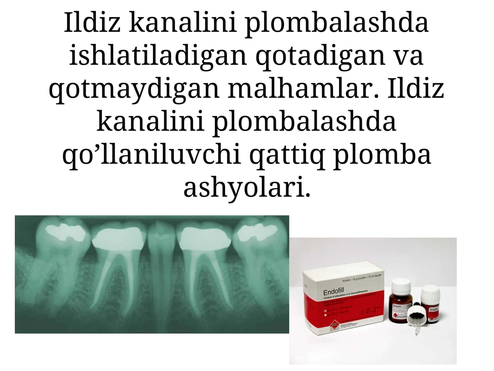 Ildiz kanalini plombalash